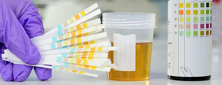 Urinprobe mit Teststreifen